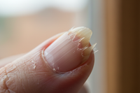 Terminas con bordes filosos e incomodidad.